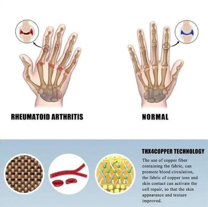 Arthritis-Kompressionshandschuhe