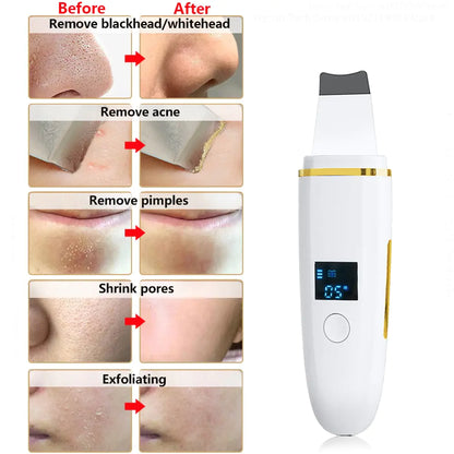 Ultrasonic Skin Scrubber: Facial Cleansing